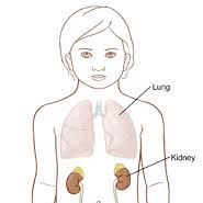 Kidney position in children