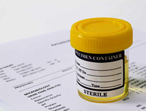 Urine Biomarkers May Diagnose Renal Cell Carcinoma