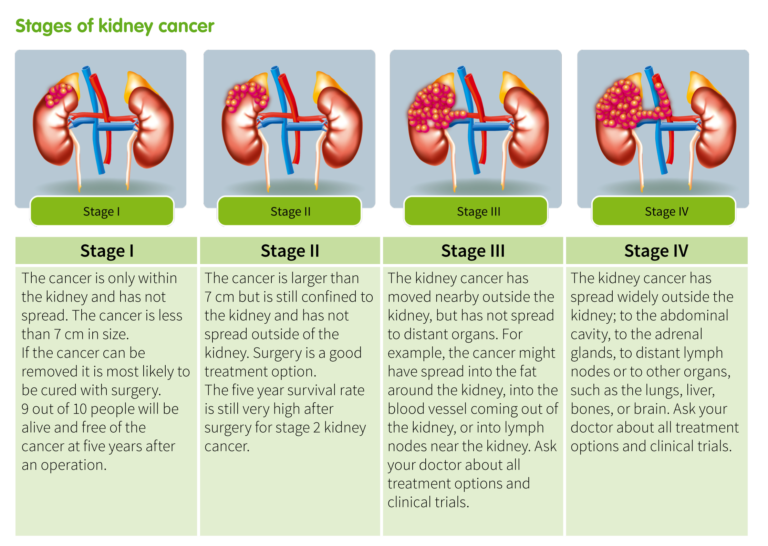 Kidney Tumor Size Chart