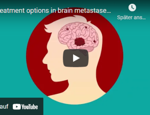 Treatment options in brain metastases in kidney cancer